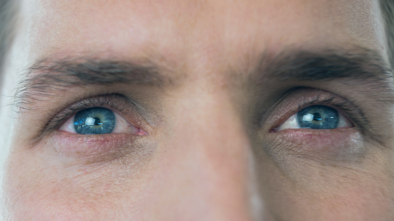 O que você precisa saber sobre a&nbsp;Catarata